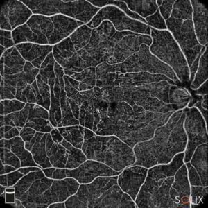 Solix Essential OCT & OCTA