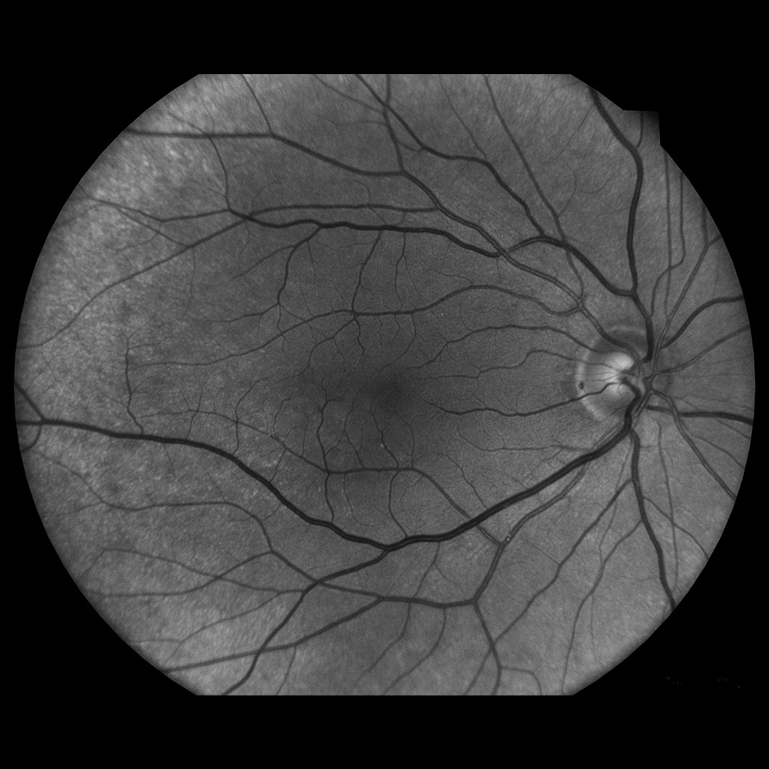 Red-free imaging modality