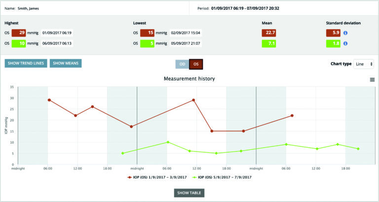 iCare CLINIC software showing IOP measurement history with trend lines and statistical analysis