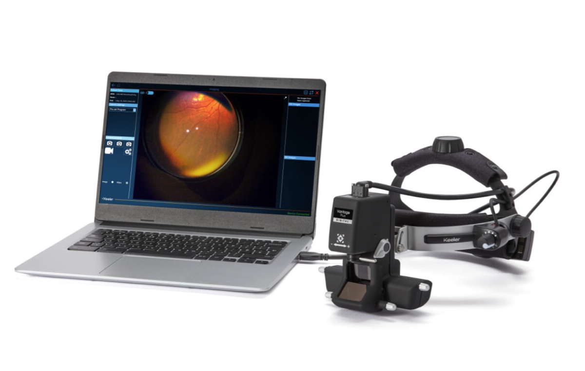 Keeler Kinexis software interface showing retinal image review on laptop