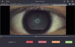Lipid Layer Thickness
