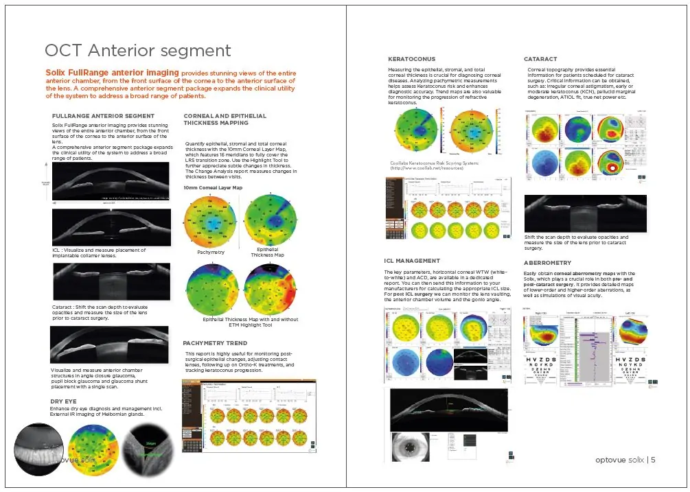 FullRange anterior segment OCT cross-section showing cornea to lens