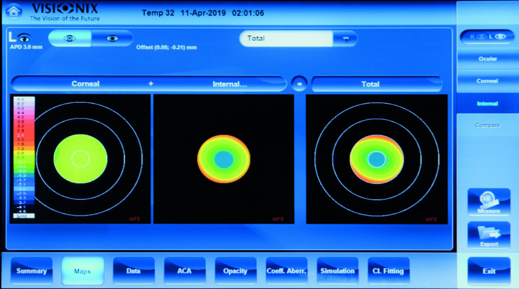 Scheimpflug cataract assessment screen with retro-illumination and wavefront analysis
